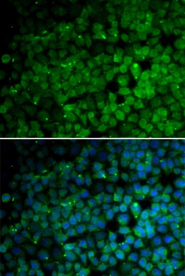 Polyclonal Rabbit anti-Human TRIM13 Antibody (IHC, IF, WB)