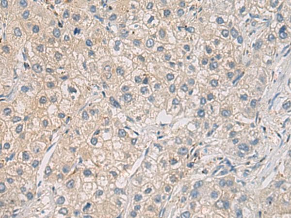 Polyclonal Rabbit anti-Human WFDC3 Antibody (IHC)