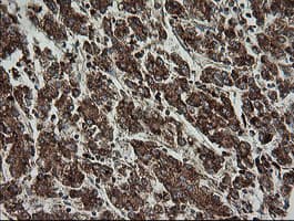 Monoclonal Mouse anti-Human TRAPPC4 / Synbindin Antibody (clone OTI2G8, IHC, WB)