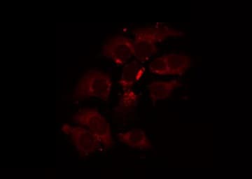 PDHA1 / PDH E1 Alpha Antibody