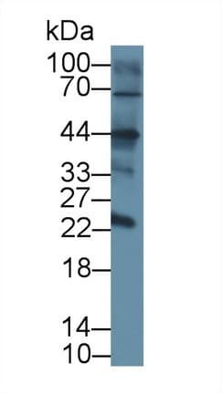 CD209 / DC-SIGN Antibody (aa115-238, APC)