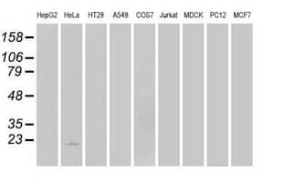 Monoclonal Mouse anti-Human AK1 / Adenylate Kinase 1 Antibody (clone OTI18C7, IF, WB)