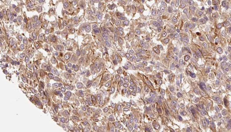 CALML3 Antibody