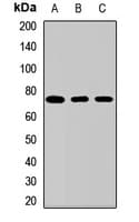 Polyclonal Rabbit anti-Human SLC13A2 / NaCT Antibody (WB)