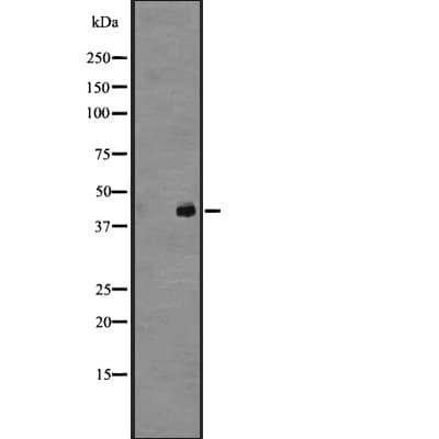 Polyclonal Rabbit anti-Human GPR45 Antibody (WB)