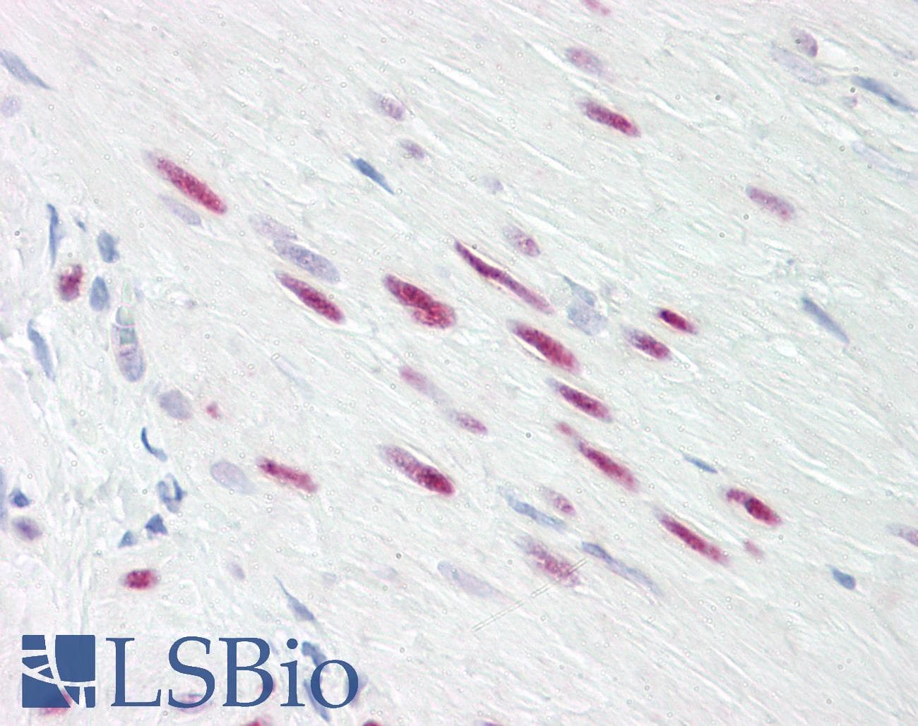 IHC-plus™ SRF / Serum Response Factor Antibody (aa71-120)