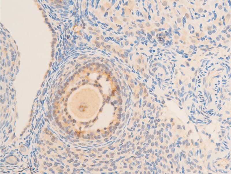 Polyclonal Rabbit anti-Human NFKBIE / IKB Epsilon Antibody (phospho-Ser22, IHC, IF, WB)