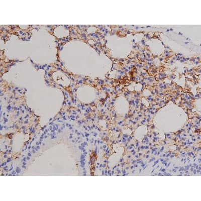 FAK / Focal Adhesion Kinase Antibody (phospho-Tyr576)