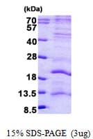 Human LAGE3 Protein (Recombinant His)