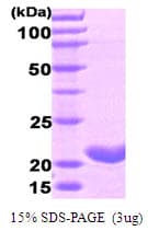 Human FTH1 / Ferritin Heavy Chain Protein (Recombinant)