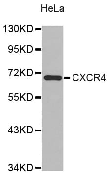 IHC-plus™ Polyclonal Rabbit anti-Human CXCR4 Antibody (IHC, WB)