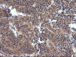 TRIM38 Antibody (aa1-265, clone OTI15A3, Carrier-free)