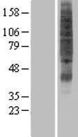 SVOPL Protein (Over-Expression Lysate Myc-DDK (Flag))