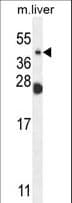 NEU4 Antibody (aa423-452)