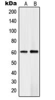 Polyclonal Rabbit anti-Human PLK5 Antibody (Internal, WB)