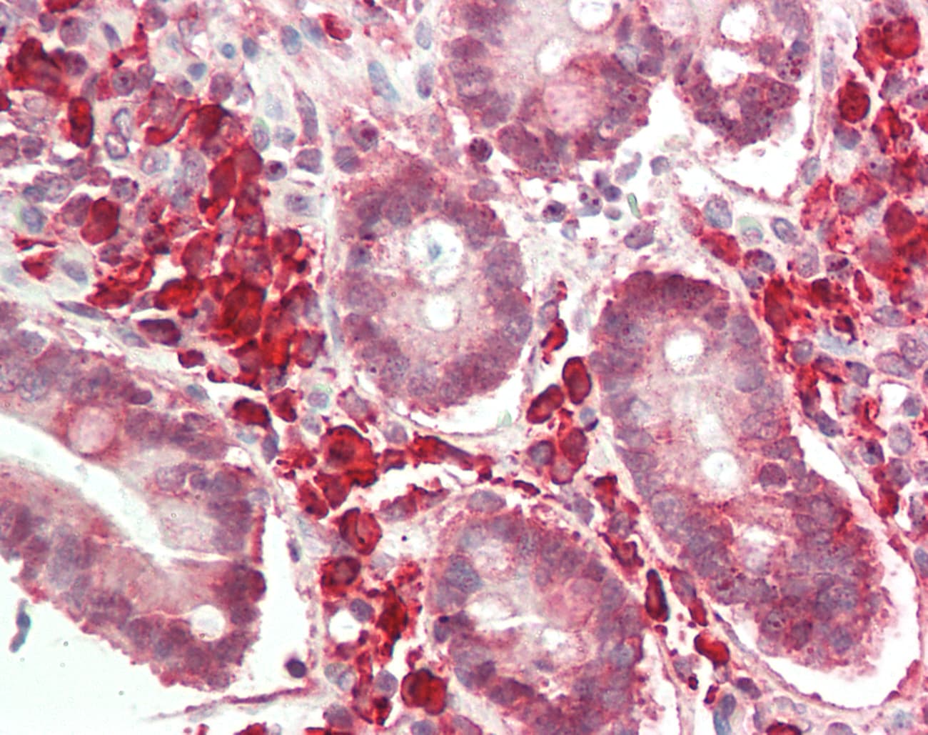 Polyclonal Rabbit anti-Human PRELP / Prolargin Antibody (aa251-300, IHC, WB)