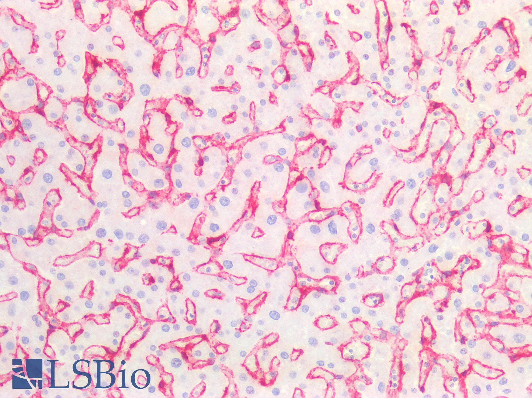 PathPlus™ CAV1 / Caveolin 1 Antibody (aa1-104)
