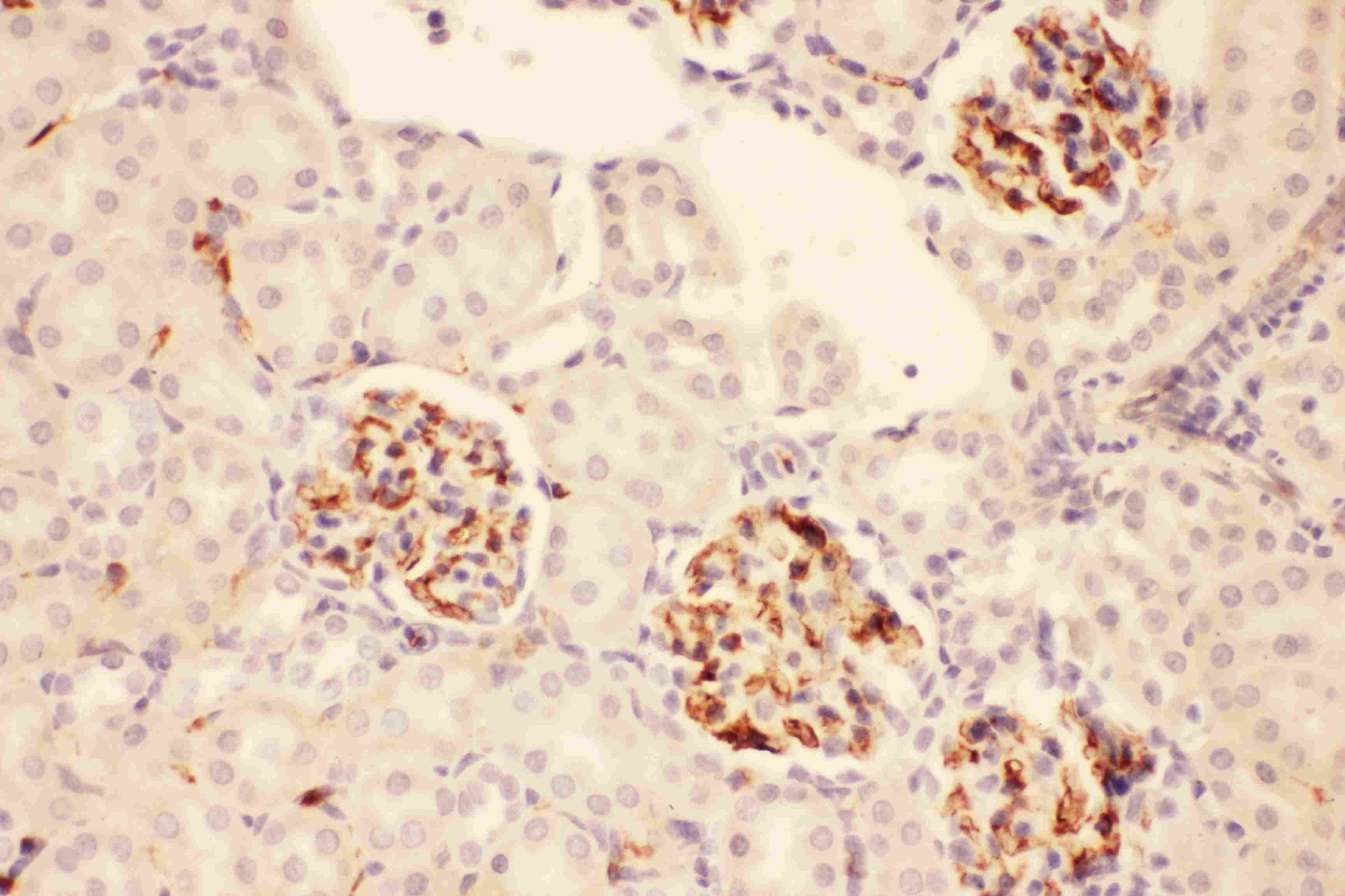 POMC / Proopiomelanocortin Antibody (aa138-176)