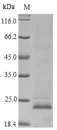 Crab-eating macaque APOC3 / Apolipoprotein C III (Recombinant 6His-SUMO, N-terminus)