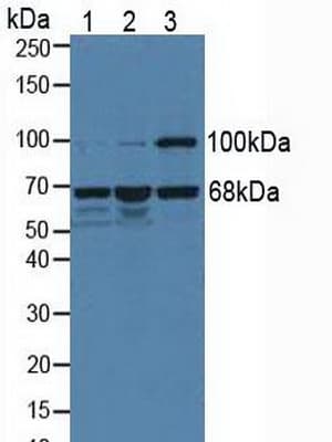 MEN1 / Menin Antibody (aa219-395, Biotin)