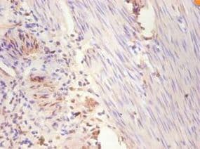 ER Alpha / Estrogen Receptor Antibody (Biotin)