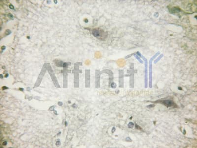 PRKD1 / PKC Mu Antibody