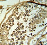 C19orf18 Antibody (aa140-168)
