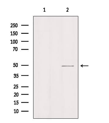 SLC16A11 Antibody