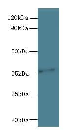 Polyclonal Rabbit anti-Human PRPSAP1 Antibody (WB)