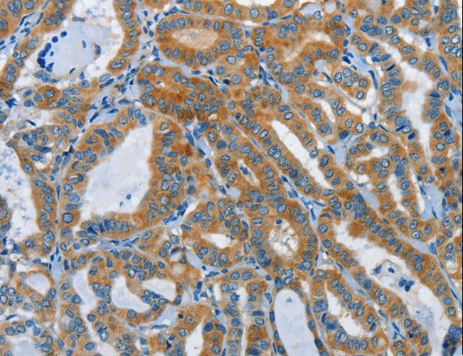 DDAH1 Antibody