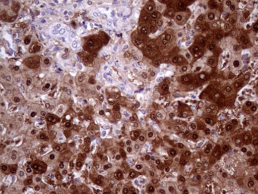 AMDHD1 Antibody (clone OTI1D4)