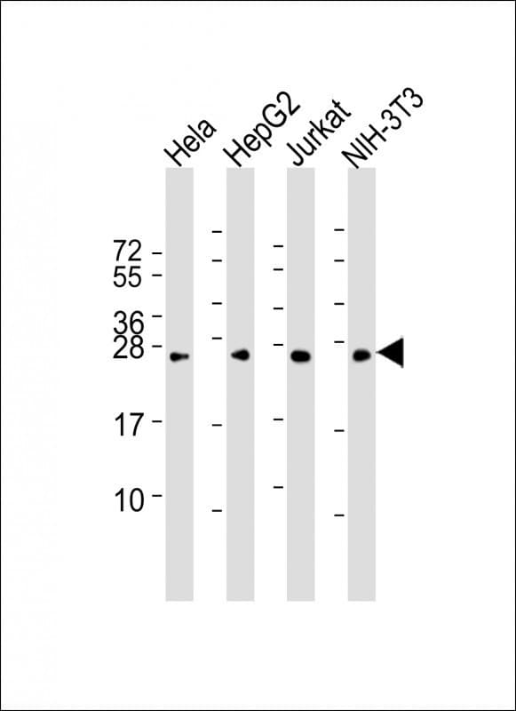 RAB5B Antibody (clone 1615CT668.28.45)