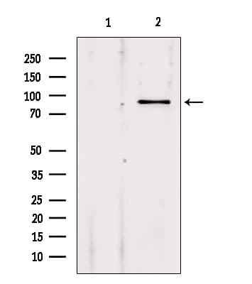 ADAR2 / ADARB1 Antibody