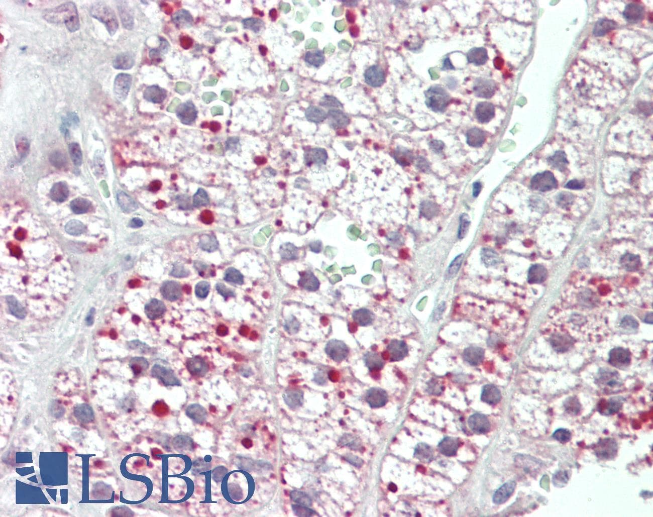 IHC-plus™ Acetyl-CoA Carboxylase / ACC Antibody (aa1925-1975)