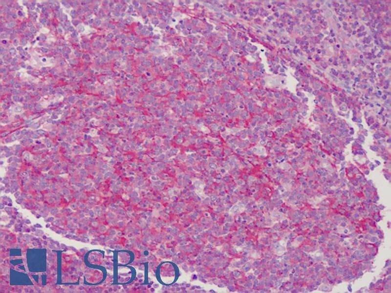IHC-plus™ Polyclonal Rabbit anti-Human TPM1 / Tropomyosin Antibody (IHC, WB)