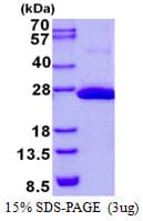 Human COMMD9 Protein (Recombinant His)