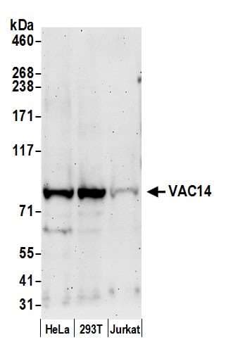 VAC14 / TRX Antibody (aa732-782)