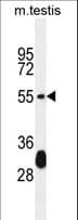 Polyclonal Rabbit anti-Human KRT33A / Keratin 33A / KRTHA3A Antibody (aa56-85, WB)