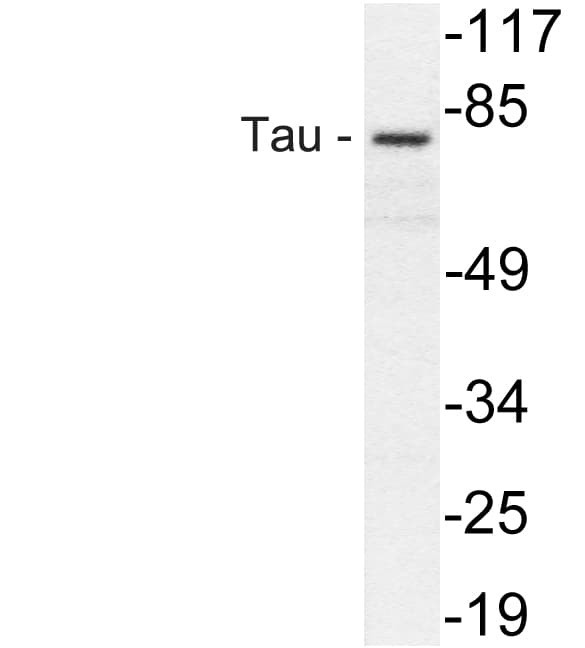 Polyclonal Rabbit anti-Human MAPT / Tau Antibody (Val229, WB)
