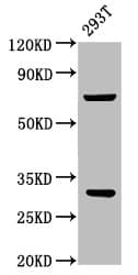 ANT2 / SLC25A5 Antibody
