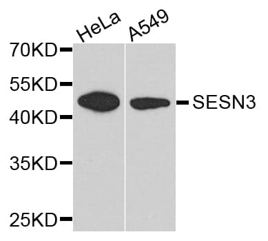Polyclonal Rabbit anti-Human SESN3 Antibody (WB)