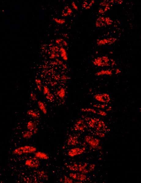 KPNA3 / Importin Alpha 4 Antibody (aa1-50)