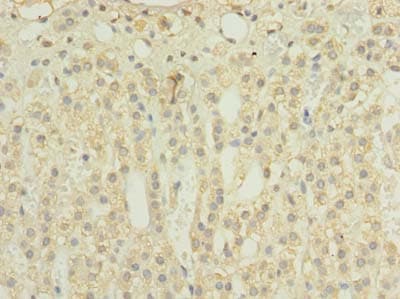 TIMM8B Antibody