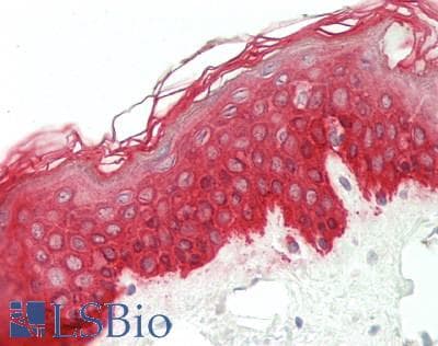 IHC-plus™ KRT6A / CK6A / Cytokeratin 6A Antibody