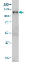 Monoclonal Mouse anti-Human NFX1 Antibody (clone 1D12, IF, WB)