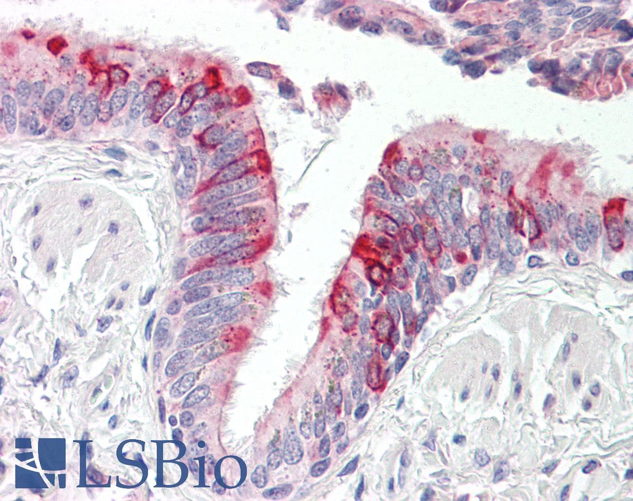 IHC-plus™ RPLP2 Antibody (aa21-70)
