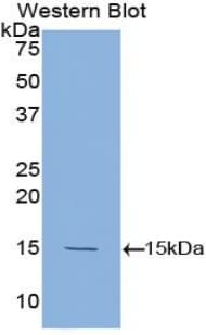 LTA / TNF Beta Antibody (aa66-185)