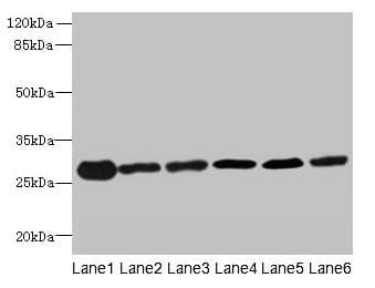 IHC-plus™ Polyclonal Rabbit anti-Human TMED9 Antibody (IHC, WB)