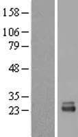 RRP1 Protein (Over-Expression Lysate Myc-DDK (Flag))