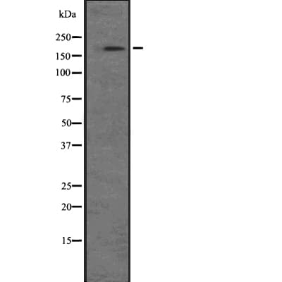 Polyclonal Rabbit anti-Human NRK Antibody (WB)